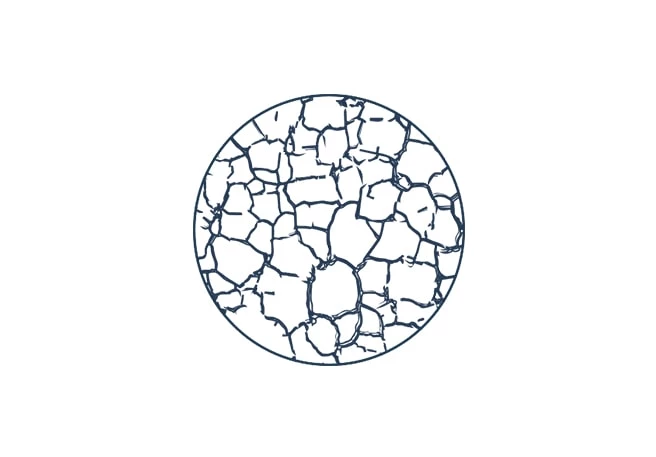 Trockene Haut Trockene Haut