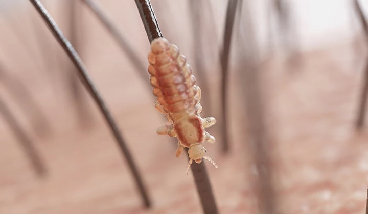 Kopflaus Kopflaus