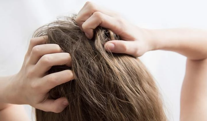 Frau juckt Kopfhaut Frau mit Juckreiz wegen Malassezia furfur