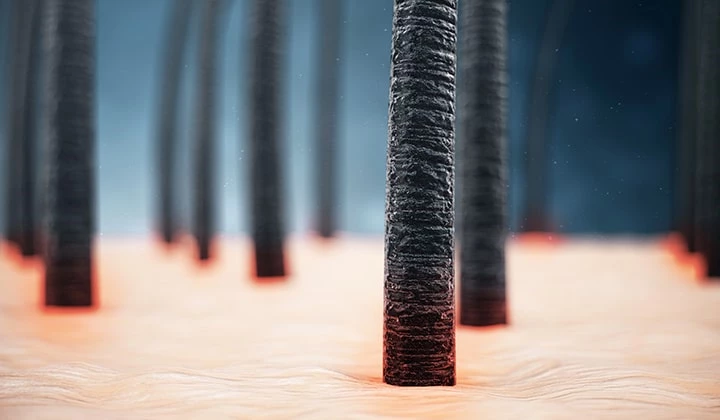 Ungesunde Haarwurzeln Ohne gesunde Kopfhaut kein gesundes Haar